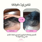 زيت بناتة ( 50 مل - 100 مل - 150 مل )