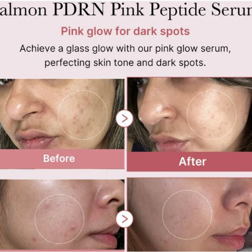 Medicube PDRN Pink Peptide Serum 30 ml