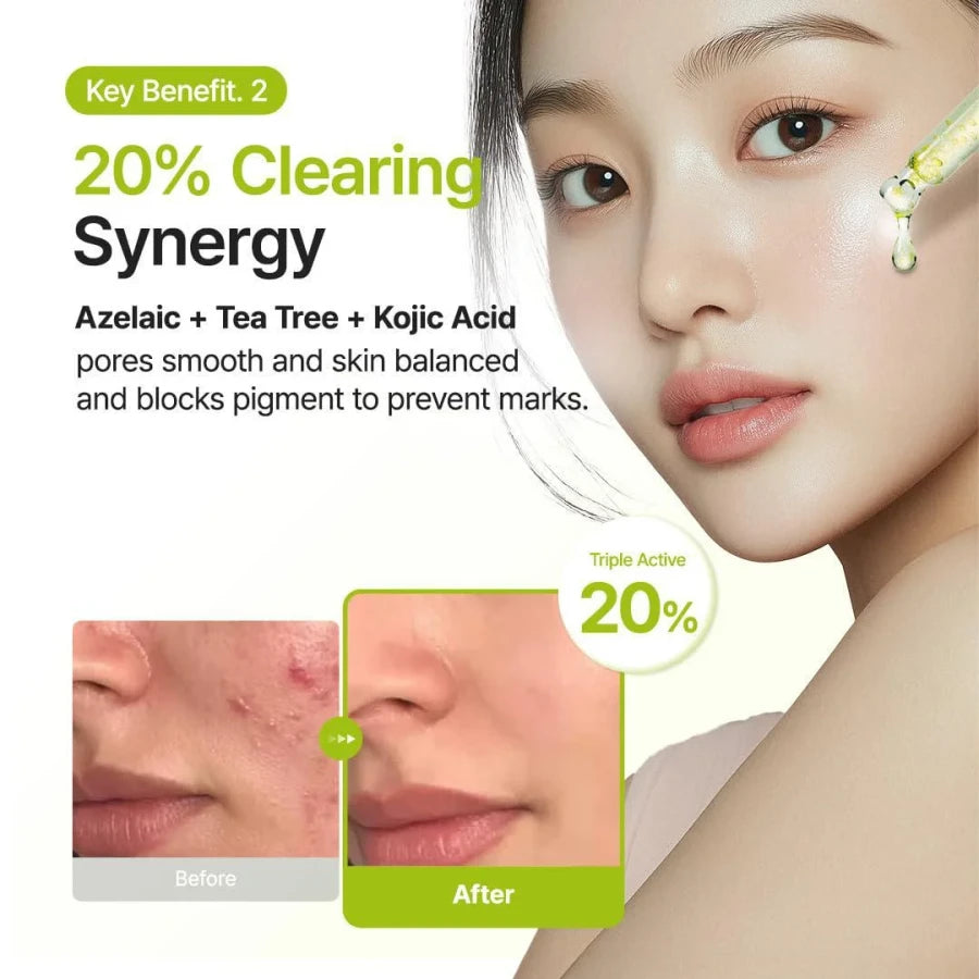 Purito Azelaic Acid 10 Kojic Tea Tree Serum Clarifying Serum 30 ml