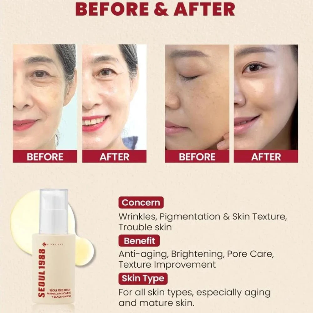 K-Secret Seoul 1988 Serum 30 ml