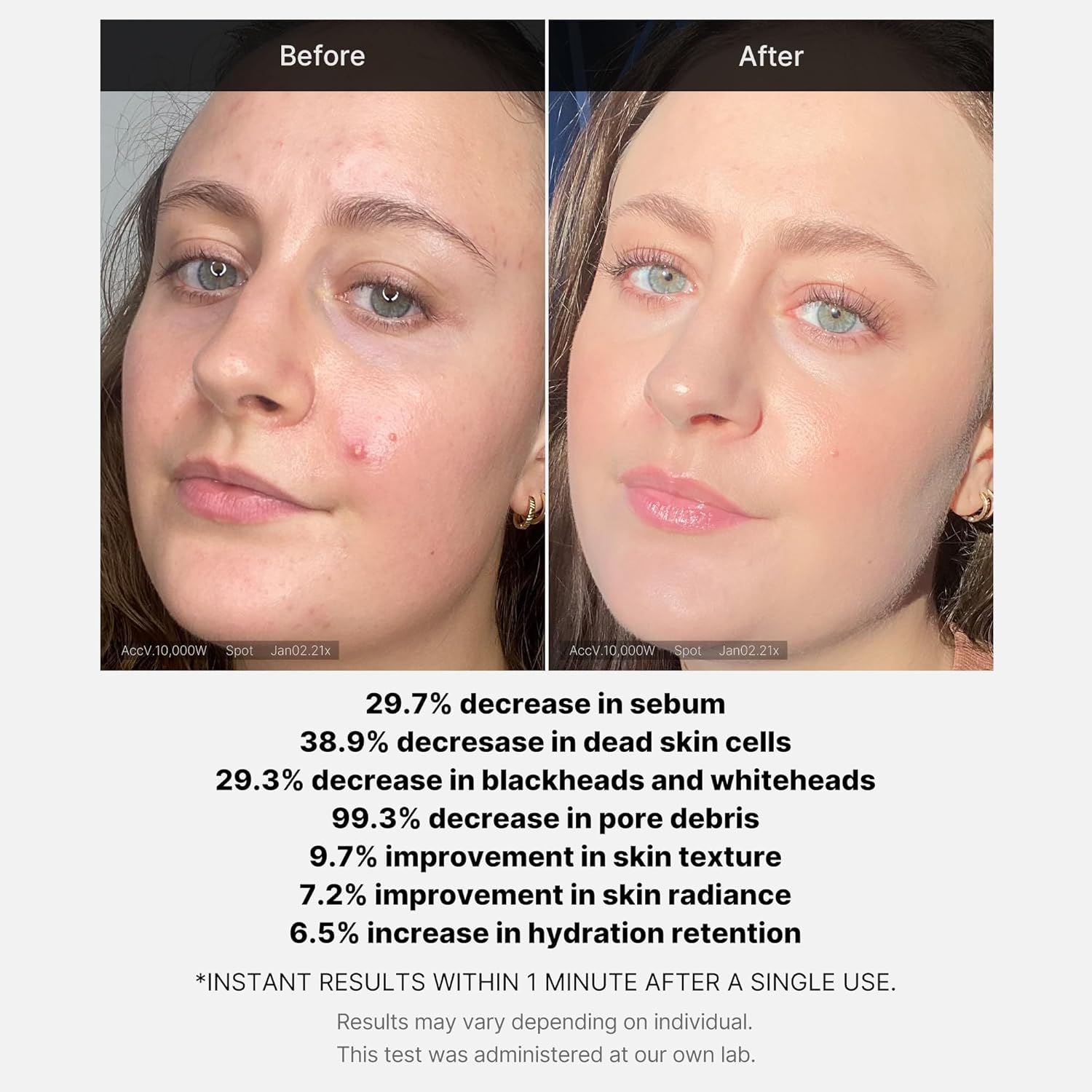 Medicube 1 Min Red Acne Succinic Acid Peel 40 g