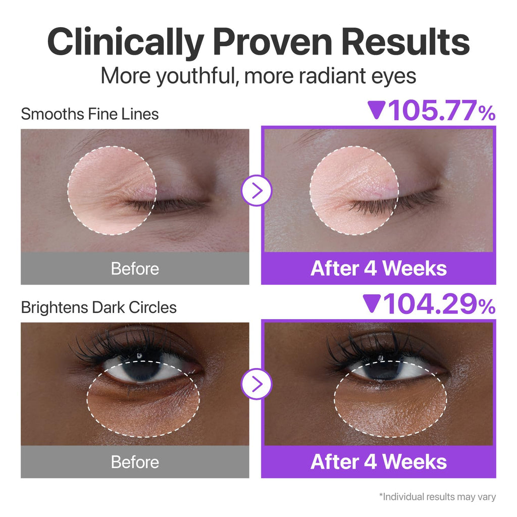 Numbuzin NAD + Retinol Volumetox Eye Cream 10 ml 9 +