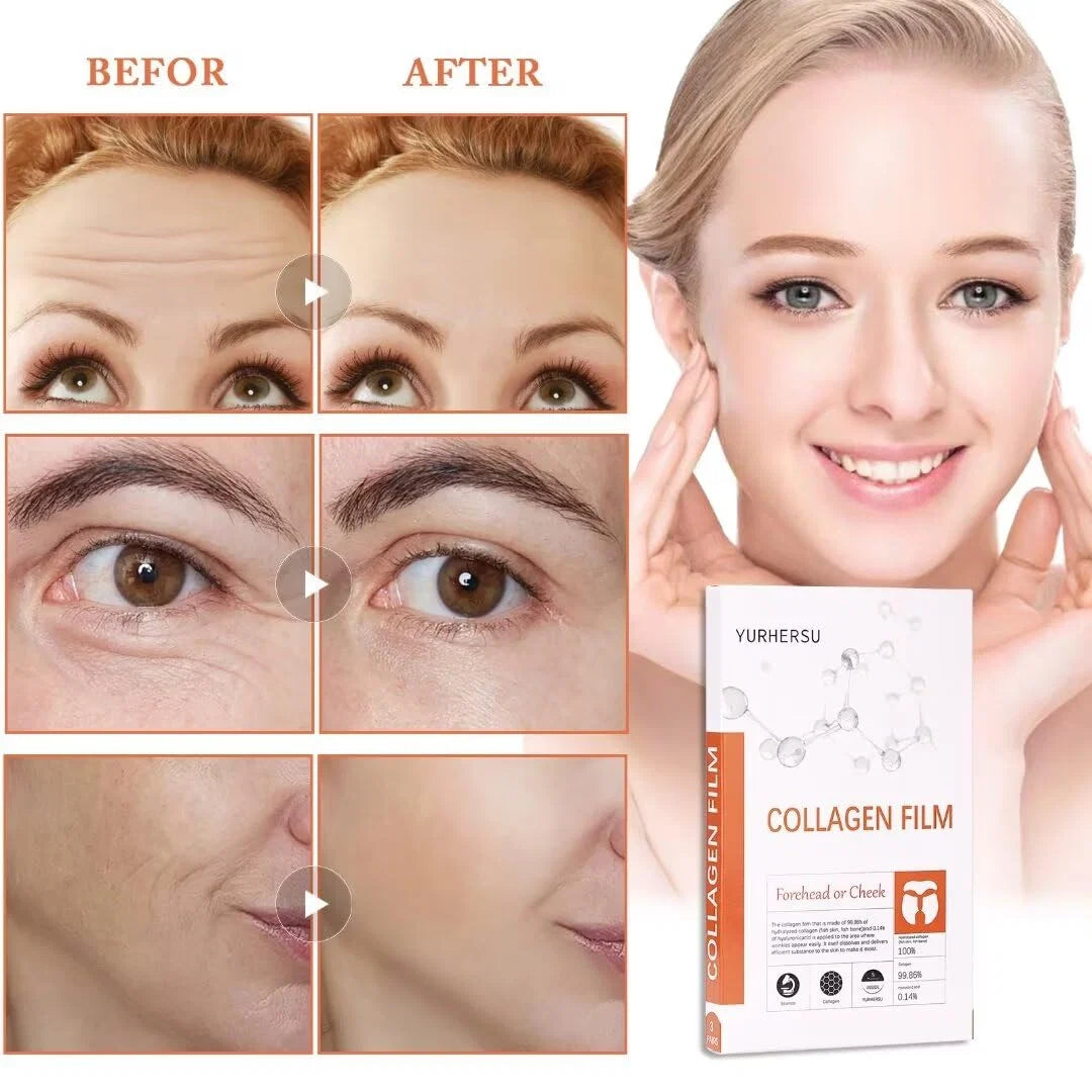 dermarssance highprime collagen flim forehead 5pcs